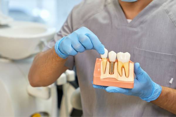 implanty zębowe Periodent