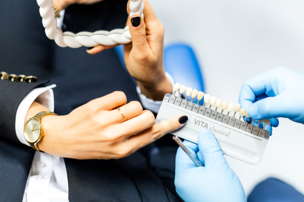 Zdjęcie przedstawia paletę kolorów licówek